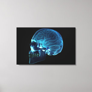 Toile Rayon X du cerveau à l'intérieur d'un crâne