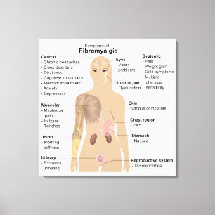Toile Symptômes du graphique Fibromyalgie Tableaux impri