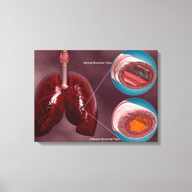 Toile Trachea Transsection Avec Poumons (Recto)