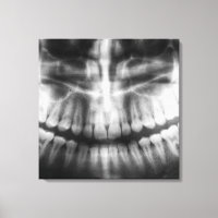 X-Ray Teeth Bouche sourire noir et blanc