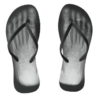 Tongs Bascules électroniques de pieds de rayon X (avec