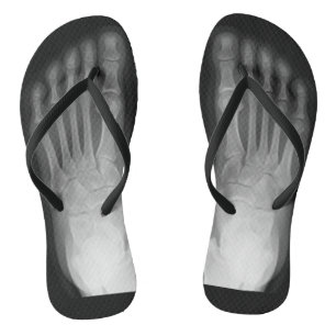 Tongs Pieds X-Ray !