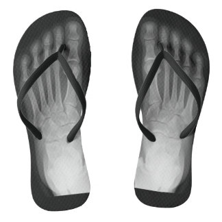 Tongs Pieds X-Ray !