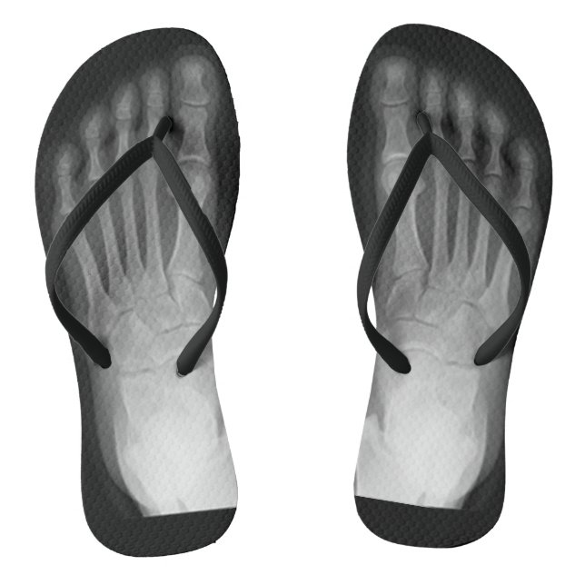 Tongs Pieds X-Ray ! (Semelle)