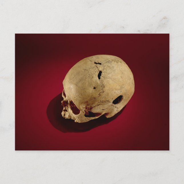 Trepanned Skull Postkarte (Vorderseite)
