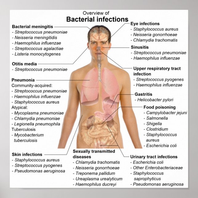 Übersicht über bakterielle Infektionen beim Mensch Poster (Vorne)