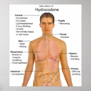 Übersicht über die Nebenwirkungen von Opioid Hydro Poster