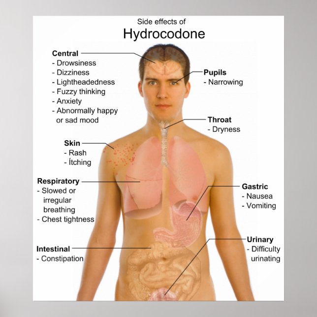 Übersicht über die Nebenwirkungen von Opioid Hydro Poster (Vorne)