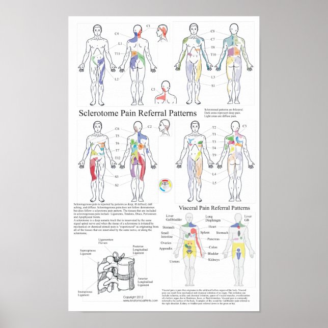 Übersicht über die visuelle Schmerzdarstellung im  Poster (Vorne)