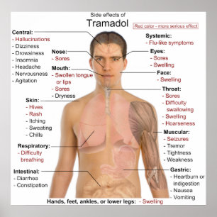 Übersicht über Nebenwirkungen von Tramadolhydrochl Poster