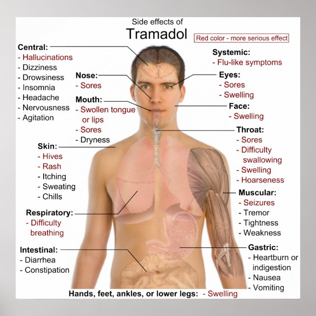 Übersicht über Nebenwirkungen von Tramadolhydrochl Poster (Vorne)