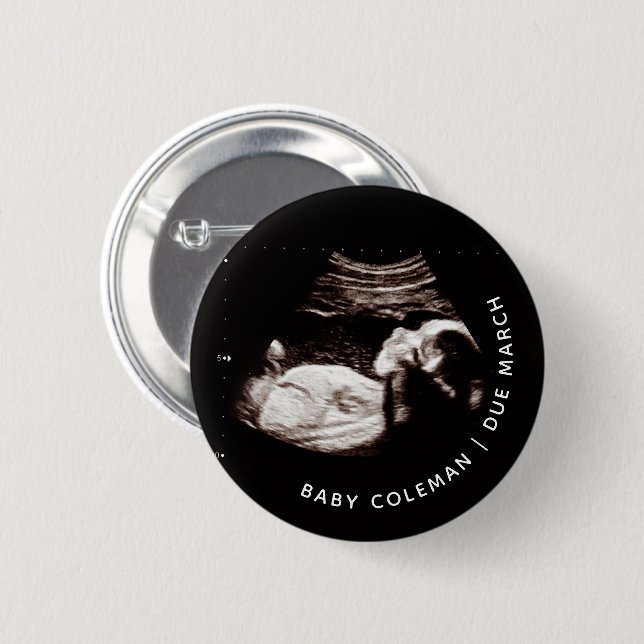 Ultraschallanzeige für Baby-Foto kommt bald Button (Vorne & Hinten)