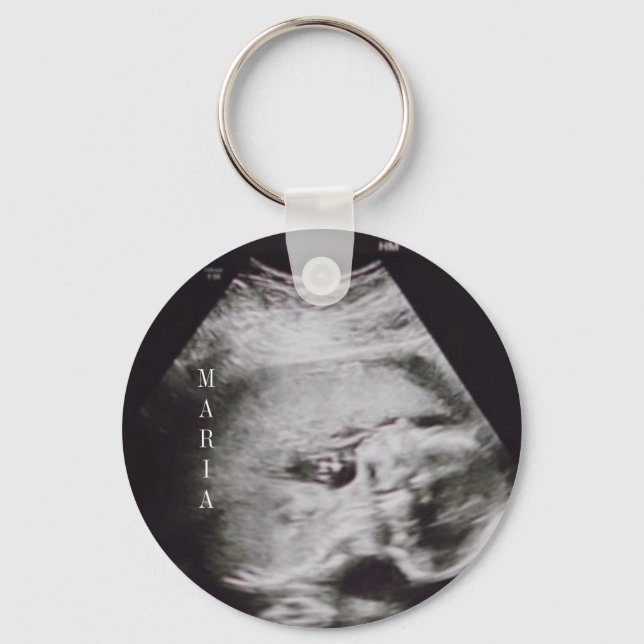 UltraschallBaby Keepake Schlüsselanhänger (Vorderseite)