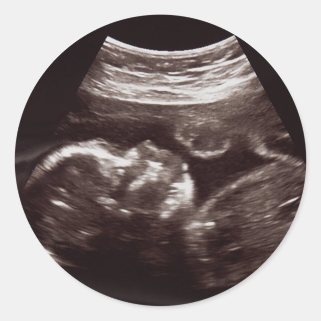 Ultrasound Foto Babydusche Danke Siegel Runder Aufkleber (Vorderseite)