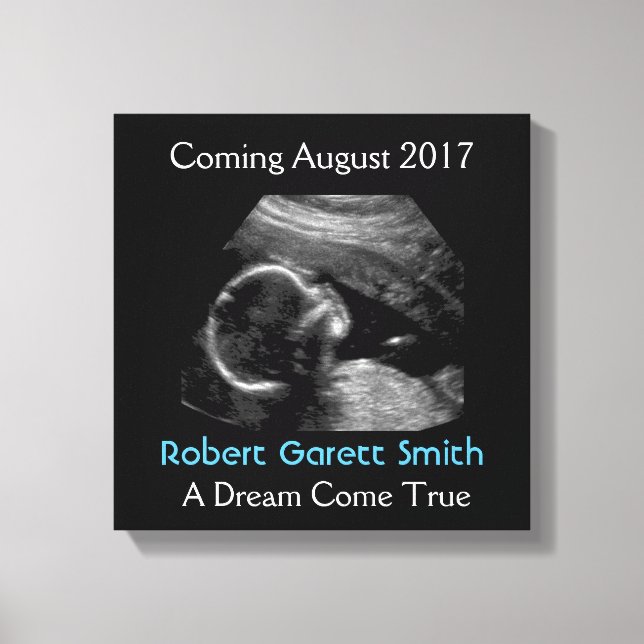 Ultrasound mit Name & Picture Leinwand Wall Hängen (Vorderseite)