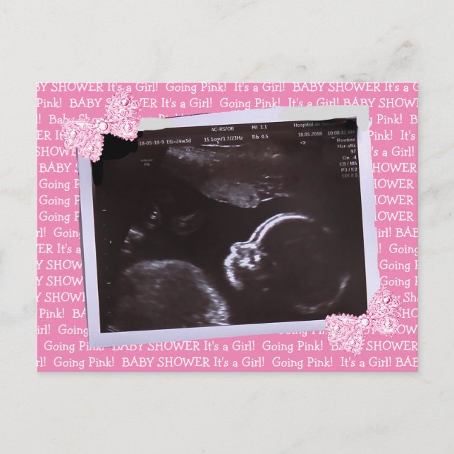 Ultrasound Picture Baby Shower Invitation Postcard Postkarte (Vorderseite)
