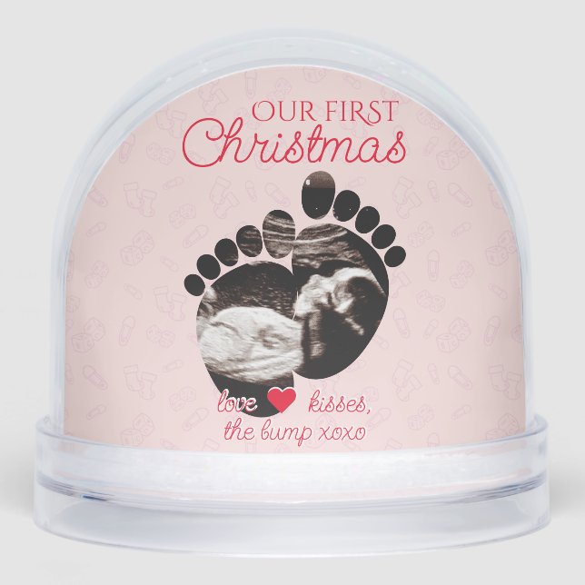 Ultrasound Pregnancy Announcement 1st Christmas Schneekugeln (Vorderseite)
