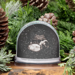Ultrasound Snow Globe Schneekugeln