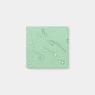 Urinalyse Hefe Mikroskop Laborschlitten Post-it Klebezettel