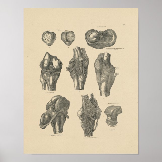 Vintag Knie Joint Anatomy 1880 Print Poster (Vorne)