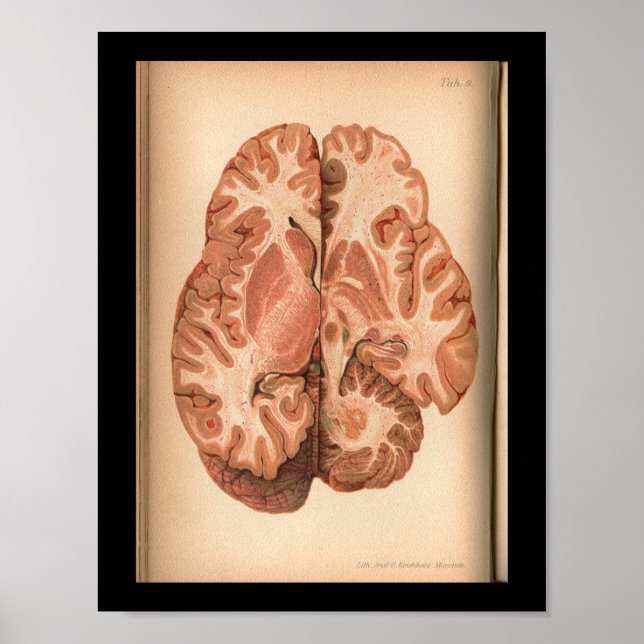 Vintage 1901 Brain Anatomy Print Poster (Vorne)