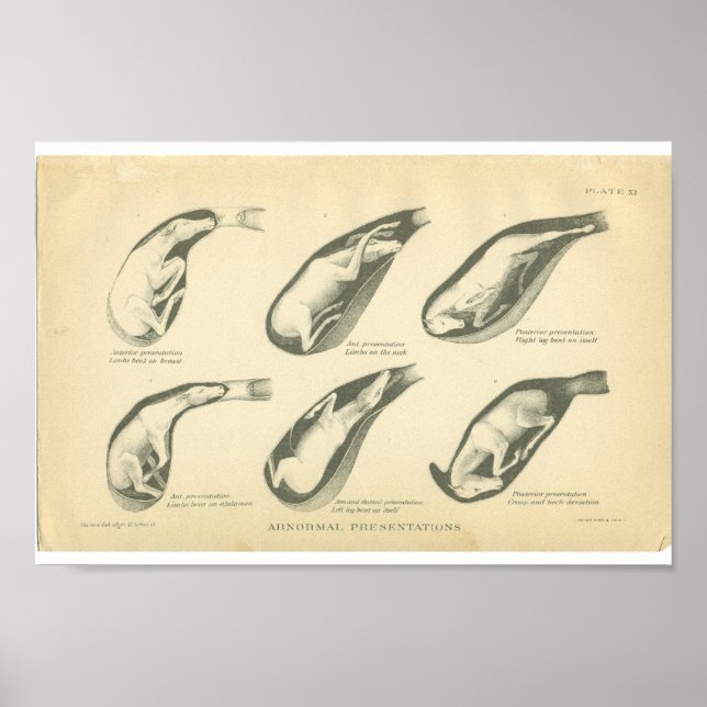 Vintage Anatomie Poster (Vorne)