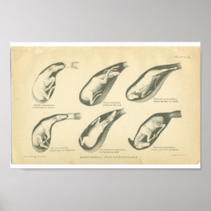 Vintage Anatomie Poster
