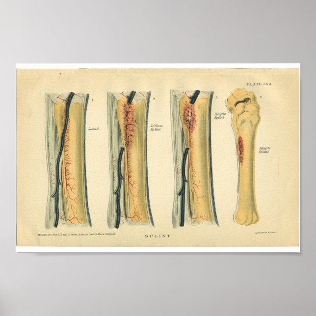 Vintage Anatomie Poster (Vorne)