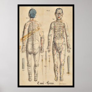 Vintage French 1825 Acupuncture Meridian Points Poster