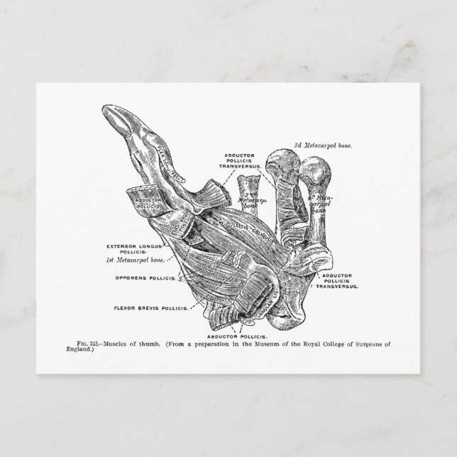 Vintage medizinische Illustration Postkarte (Vorderseite)