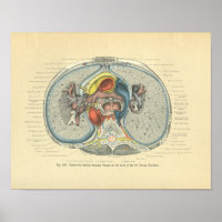 Vintage Morbus Frohse