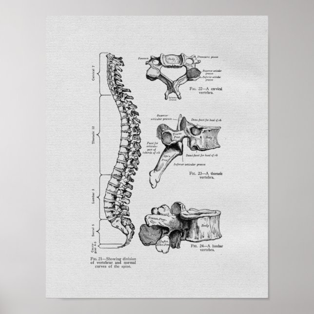 Vintage Spine und Vertebrae Poster (Vorne)