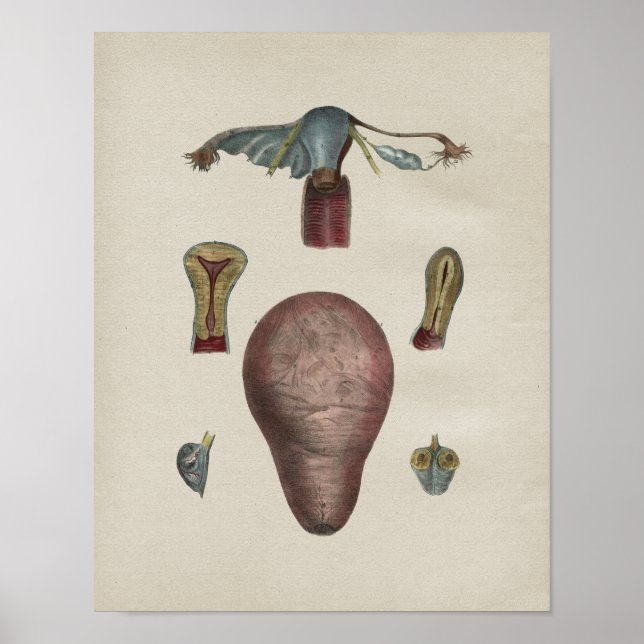 Vintage Uterus-Anatomie Poster (Vorne)