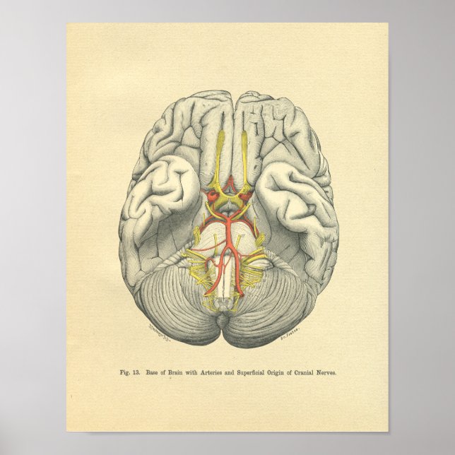 Vintager Frohse Anatomische Hirnhautentzündungen Poster (Vorne)