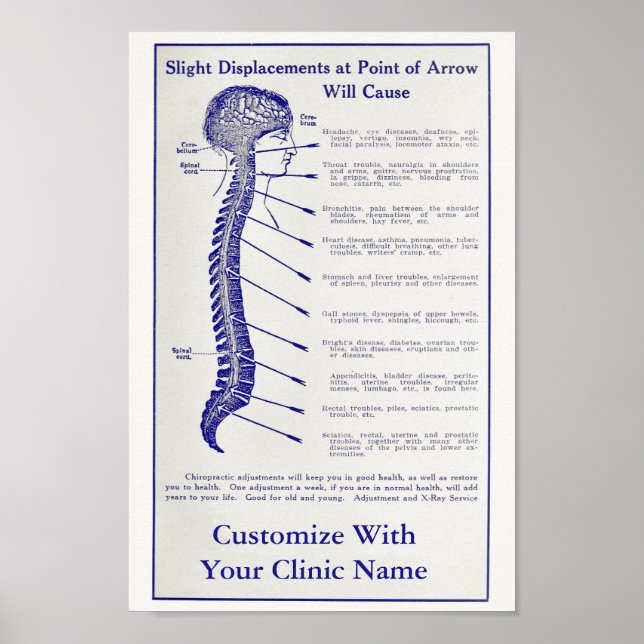 Vintages 1921 Chiropractic Ad Art Poster individua (Vorne)