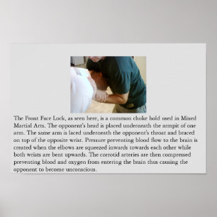 Vorderer Gesichts-Verschluss oder vordere Poster