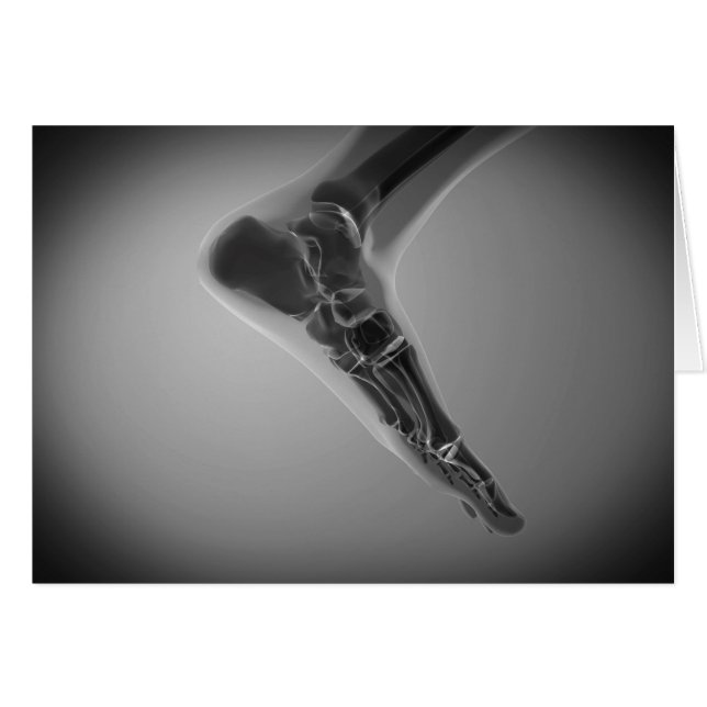 Vue En Rayon X Du Pied Humain 4 (Devant horizontal)