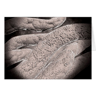 Vue Microscopique De La Formation De Corncob