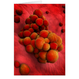 Vue Microscopique De La Tumeur 2