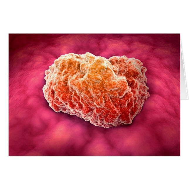 Vue Microscopique De La Tumeur 3 (Devant horizontal)