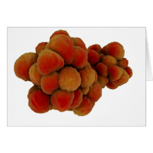 Vue Microscopique De La Tumeur 4