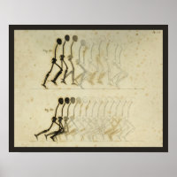 Wanderung Gait Analysis Leg Spine Chiropractic Cha