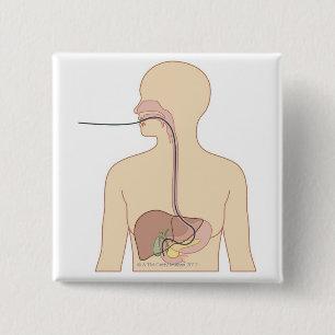 Weg von Endoscope Button