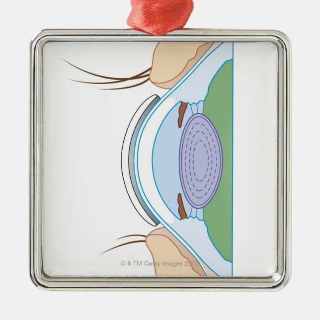 Weiche Kontaktlinse Ornament Aus Metall (Vorne)