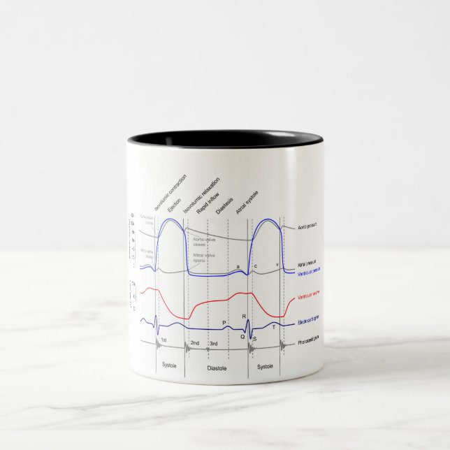 Wiggers Diagramm Kardiakzyklische Ereignisse verla Zweifarbige Tasse (Mittel)