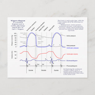 Wiggers-Diagramm Postkarte
