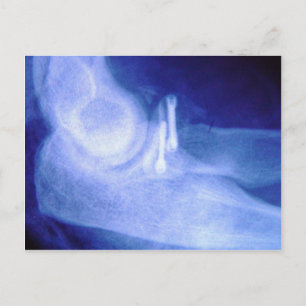 Winkelaufnahme mit Schrauben Postkarte