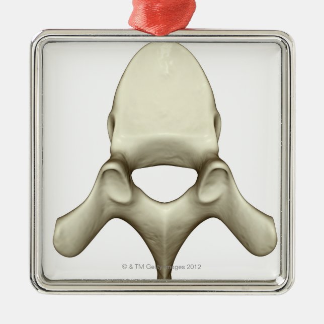 Wirbel Ornament Aus Metall (Vorne)