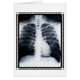 X-Ray-Brust
