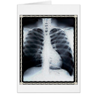 X-Ray-Brust